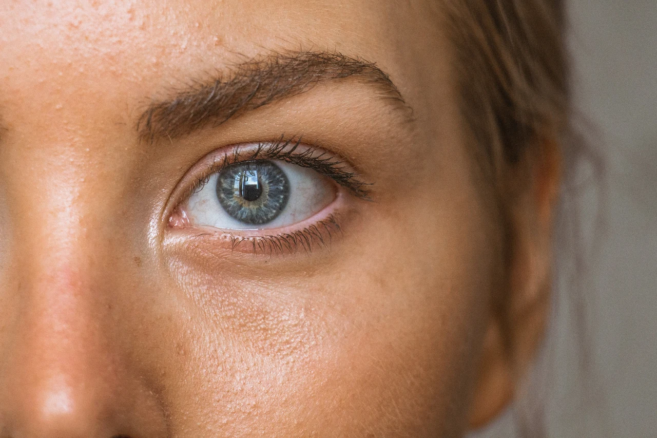 Acne estiva? Scopri quale frutto di stagione può aiutarti Acne estiva? Scopri quale frutto di stagione può aiutarti